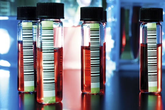 Vials of medicine with red liquid stand on a table.