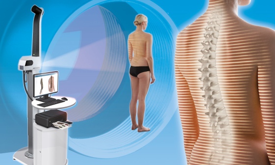 Optical spine and posture analysis with uEye industrial cameras