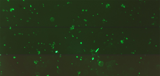 The camera captures human cells that emit different amounts of green light depending on the rate of senescence
